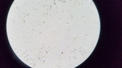 Zhuliangomyces illinitus