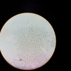 Chlorosplenium