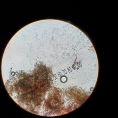 Chlorosplenium