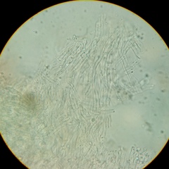 Cyphellostereum pusiolum