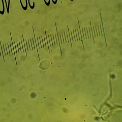 Ripartitella brasiliensis
