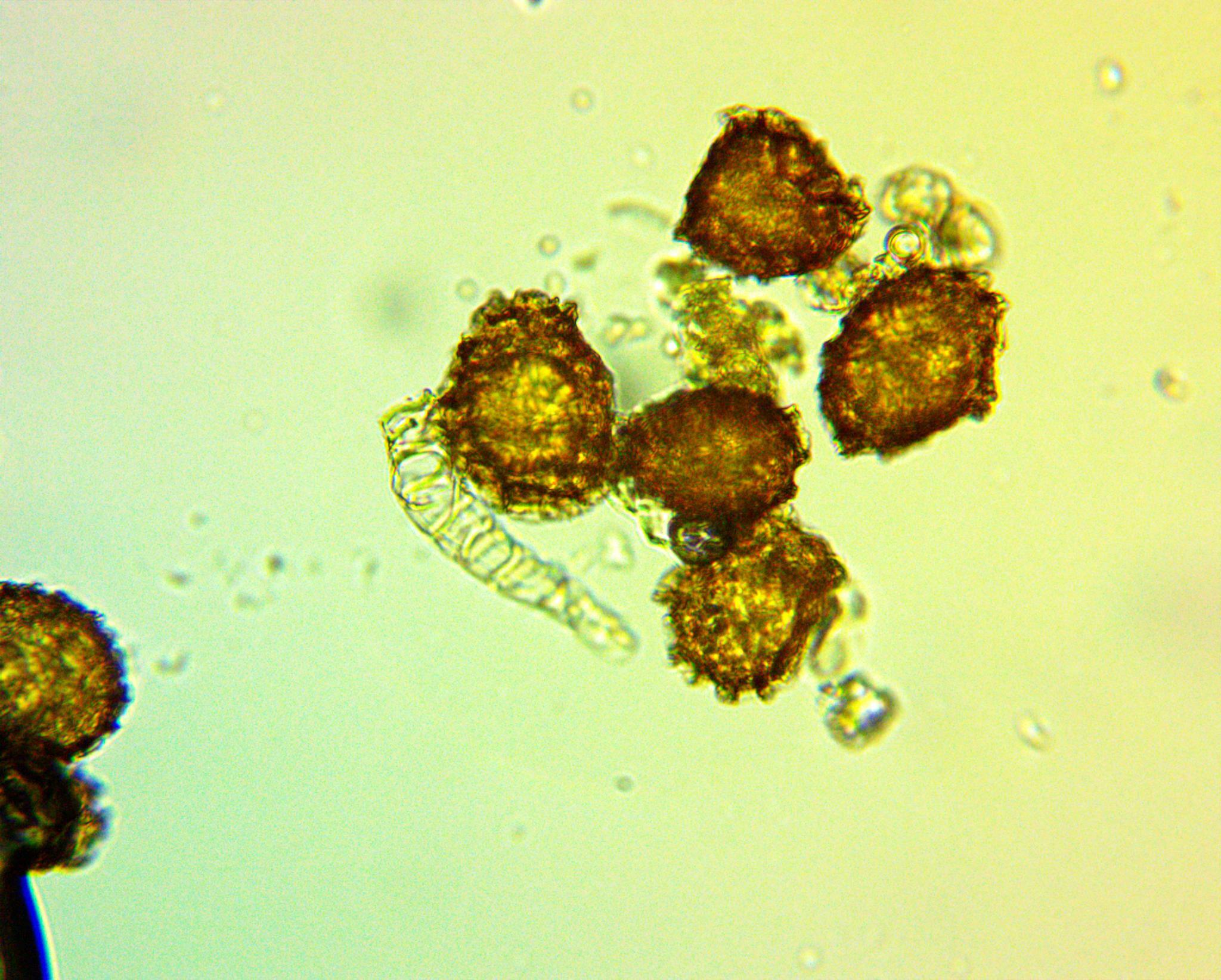 Fossombronia cristula