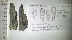 Arthonia nigrocincta