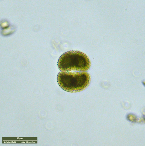 Cosmarium reniforme var. compressum