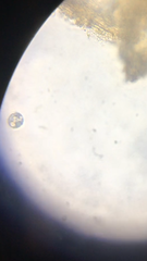 Balantidium