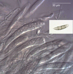 Lophiostoma