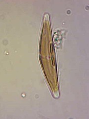 Cymbella