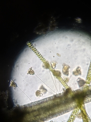 Vorticella