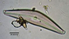 Cymbella