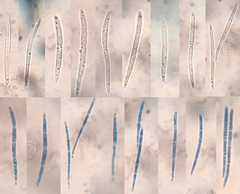Arachnopeziza delicatula