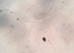 Arachnopeziza delicatula