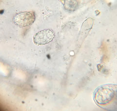 Scutellinia pennsylvanica image