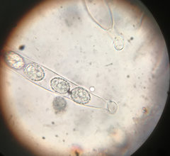 Scutellinia pennsylvanica image