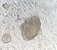 Protoperidinium