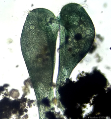 Stentor coeruleus