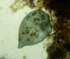 Stentor coeruleus