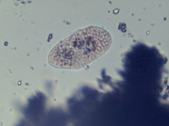 Entamoeba