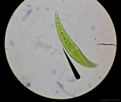 Closterium moniliferum