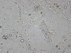 Amoebophilus simplex