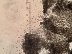 Chaenothecopsis perforata