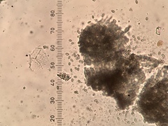 Chaenothecopsis perforata