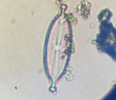 Bacillariophycidae
