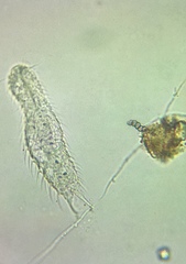 Gastrotricha