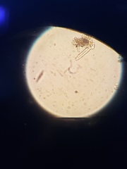 Planktothrix prolifica
