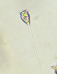 Vorticella