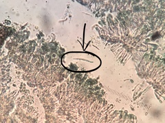 Bacidia circumspecta