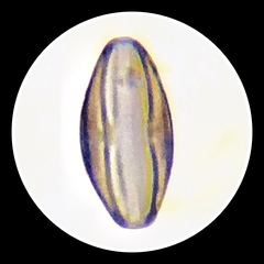 Amphora