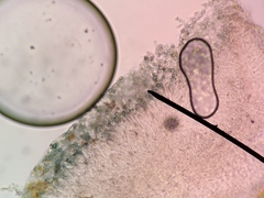 Bacidia circumspecta