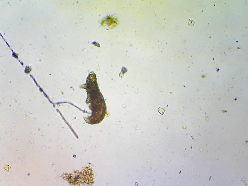 Eutardigrada