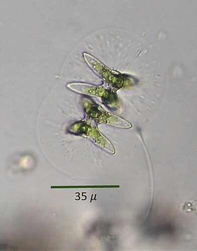 Staurastrum sublaevispinum