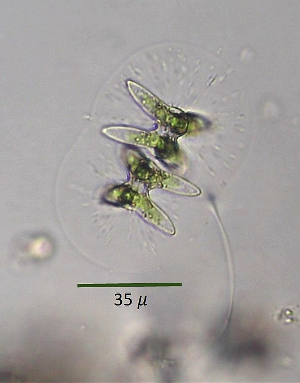 Staurastrum sublaevispinum