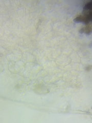 Trichoderma sinuosum