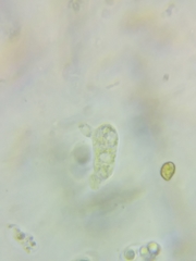 Dacrymyces corticioides