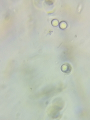 Dacrymyces corticioides