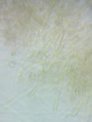 Dacrymyces corticioides