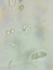 Dacrymyces corticioides