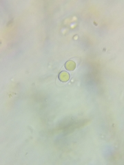 Dacrymyces corticioides