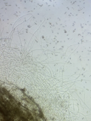 Dacrymyces corticioides