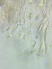 Dacrymyces corticioides