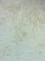 Dacrymyces corticioides