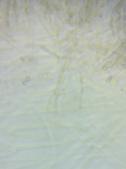 Dacrymyces corticioides