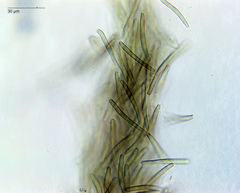 Pseudophaeophleospora phormii