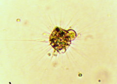 Heliozoa