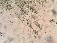 Botryolepraria lesdainii