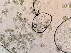 Botryolepraria lesdainii