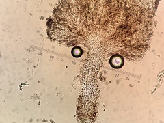 Chaenothecopsis pusilla